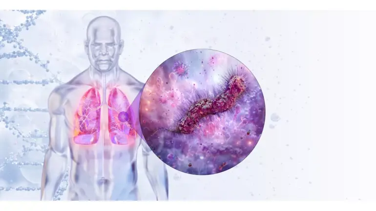 Legionnaires’ Disease Outbreaks Put Spotlight on HVACR’s Role in Prevention